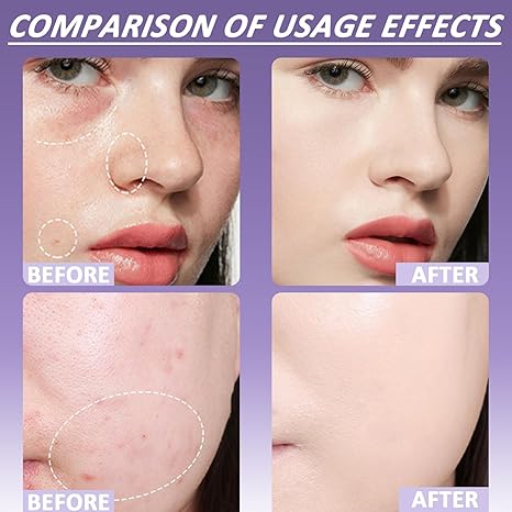 🔥 LAST DAY 49%OFF🔥Soft Matte Cream Concealer