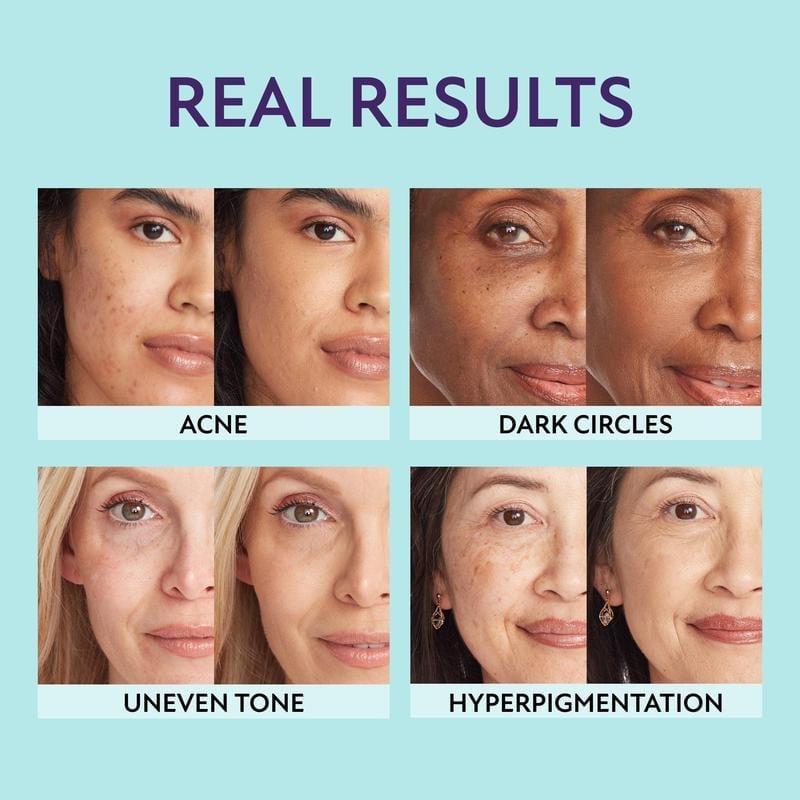 (🛩️Buy 2 get 1 free free shipping)All-in-one moisturizer, concealer & coverage✨