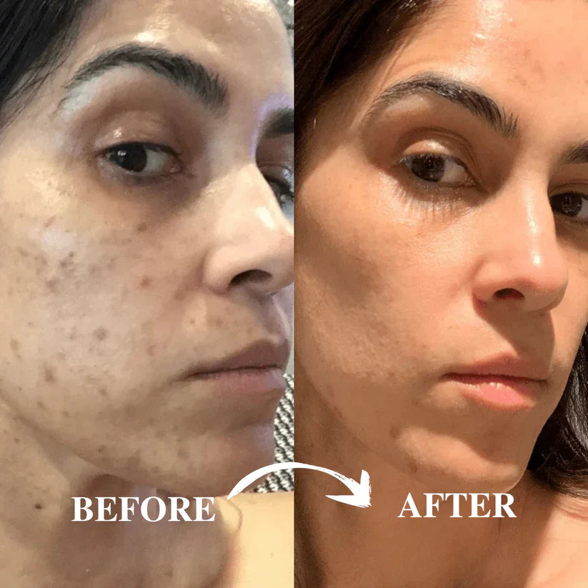 🏆Flash Sale⚡ 50K+ SOLD! Almost Gone-💥🔥Peel Shot Glow Rice Ampoule Duo