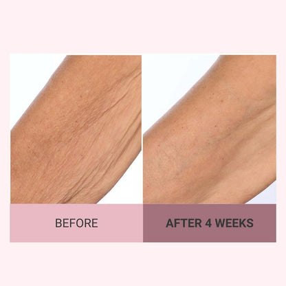 ✨ Revitalize Your Skin - 49% OFF - ✨ Consult Beaute Champagne Beaute Lift Firming Body Crème - For Smoother, Firmer, Radiant Skin