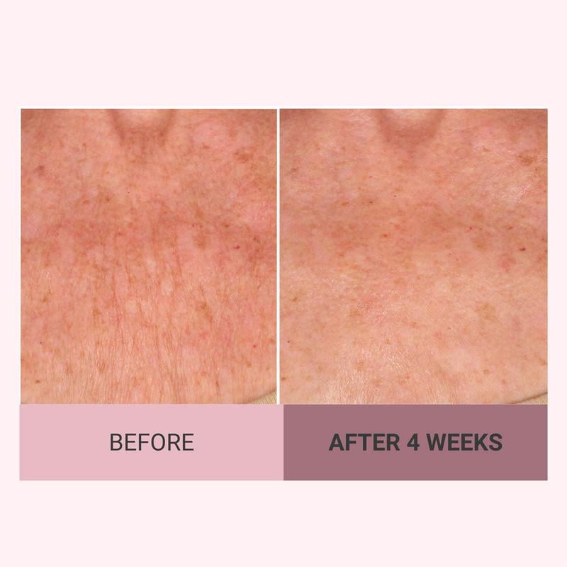 ✨ Revitalize Your Skin - 49% OFF - ✨ Consult Beaute Champagne Beaute Lift Firming Body Crème - For Smoother, Firmer, Radiant Skin