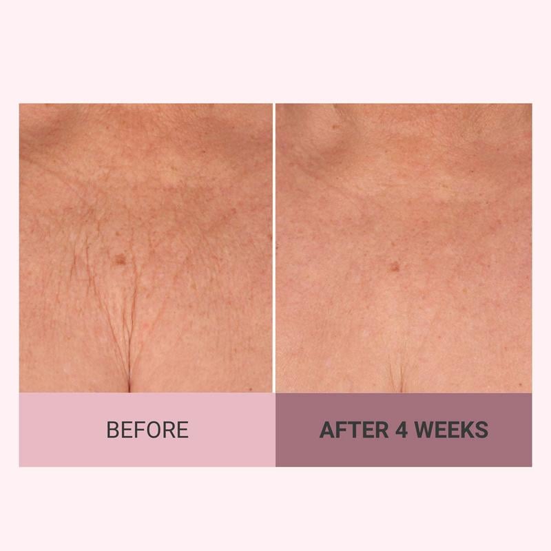 ✨ Revitalize Your Skin - 49% OFF - ✨ Consult Beaute Champagne Beaute Lift Firming Body Crème - For Smoother, Firmer, Radiant Skin