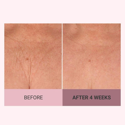 ✨ Revitalize Your Skin - 49% OFF - ✨ Consult Beaute Champagne Beaute Lift Firming Body Crème - For Smoother, Firmer, Radiant Skin