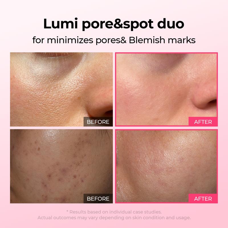 Lumi Pore & Spot Care Duo | Shrinks Pores & Fades Blemish Marks
