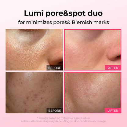 Lumi Pore & Spot Care Duo | Shrinks Pores & Fades Blemish Marks